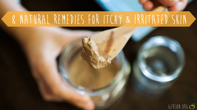 8 Natural Remedies for Itchy and Irritated Skin
